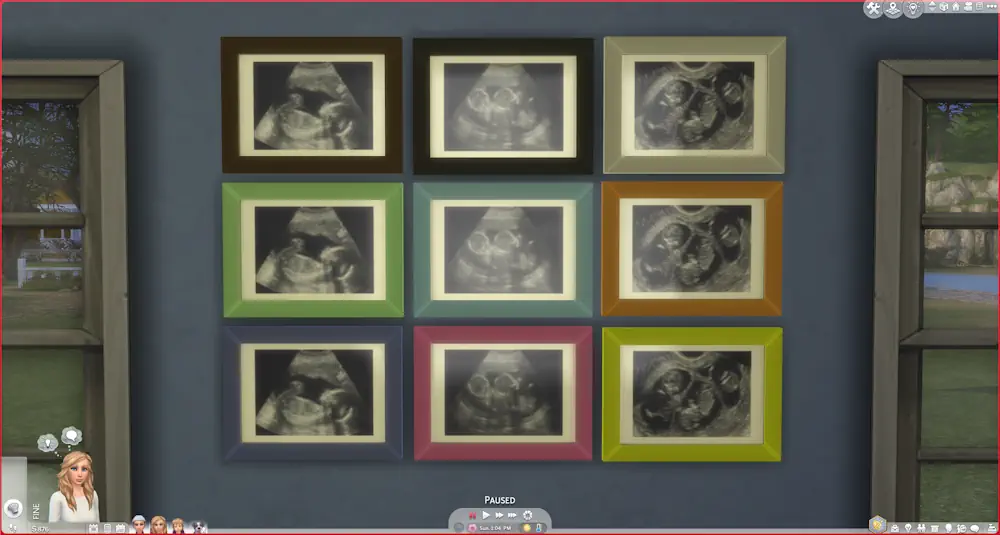 Ultrasound Scan Mod image